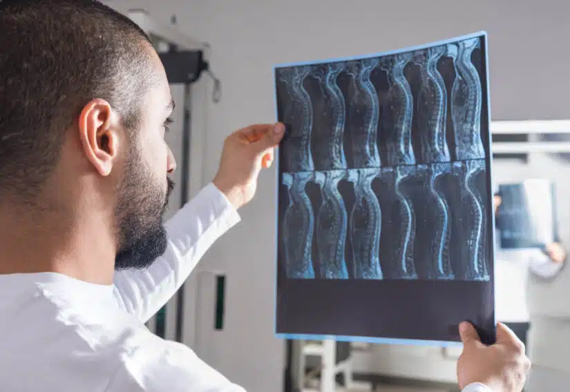 Spinal Cord injuries-doctor reviewing x-ray