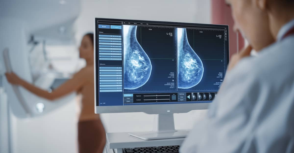 Doctor looking at mammogram. | Bernheim Kelley